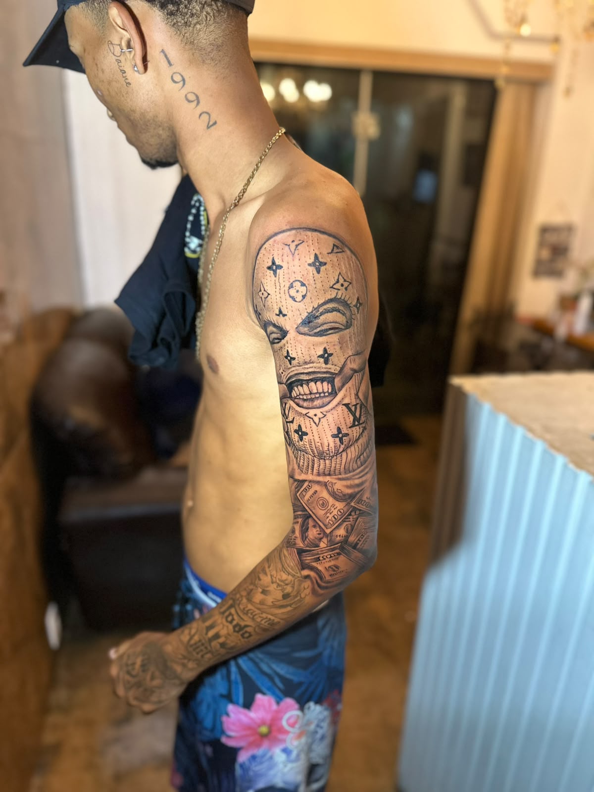 Fechamento de braço